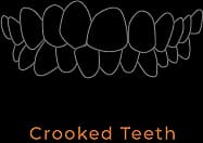 Crooked Teeth illustration