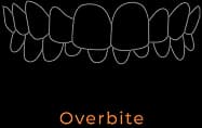 Overbite illustration