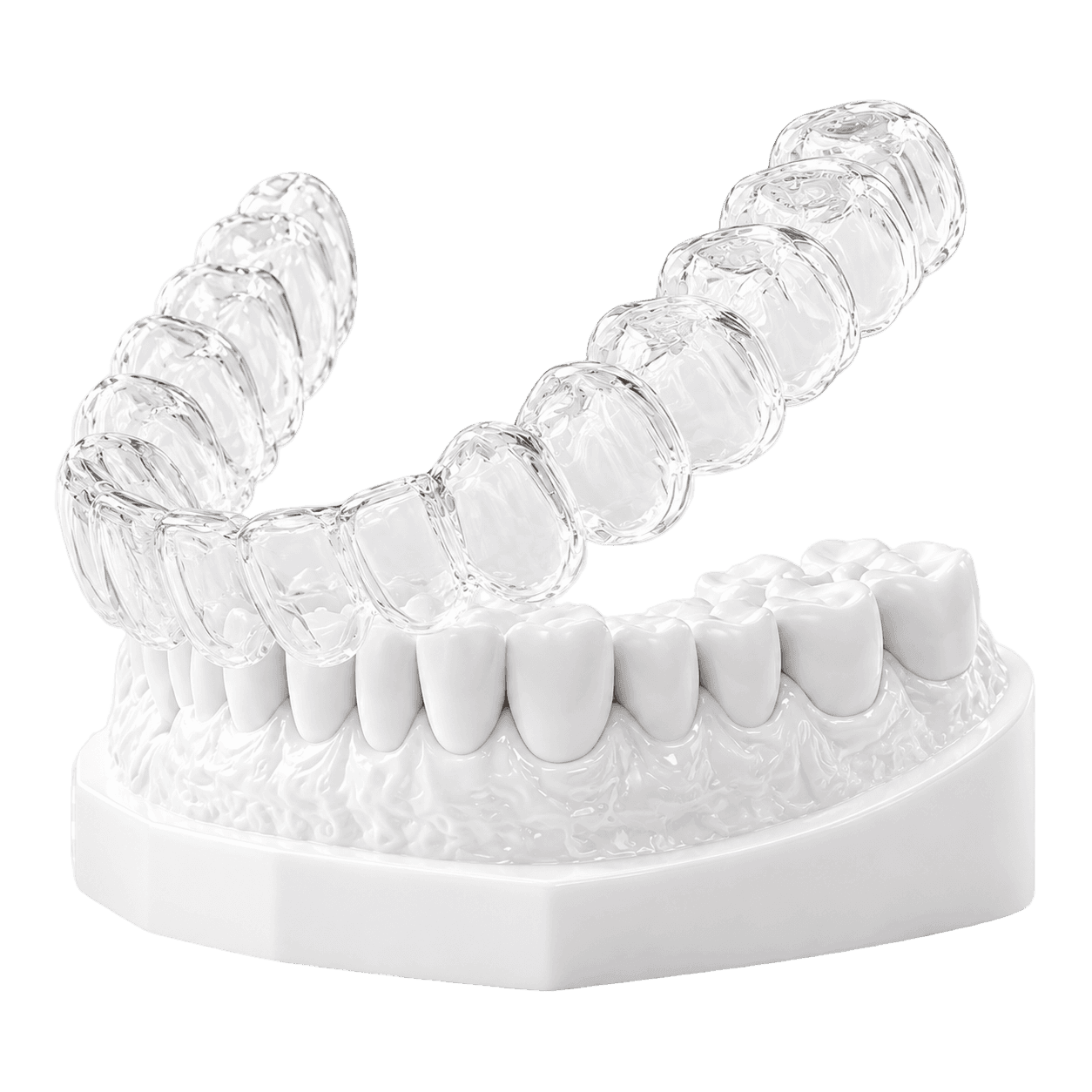 Clear aligner on a dental model