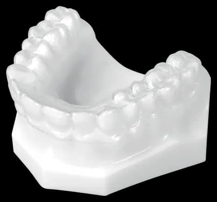 Clear Essix retainer on an upper arch