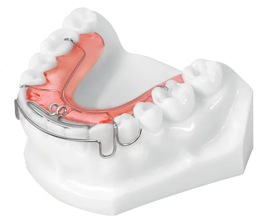 Active Retainer