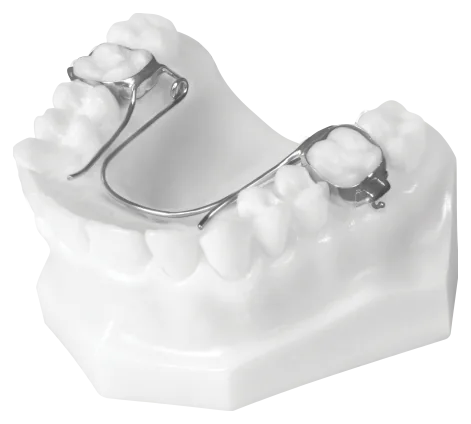 Bi Helix (Upper)