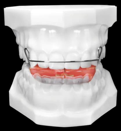 Bionator (To open or close)
