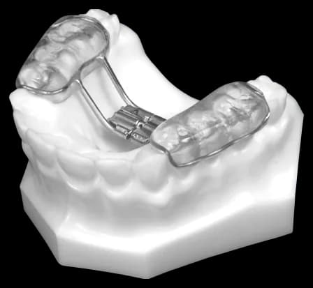 Bonded RPE (Upper Only)