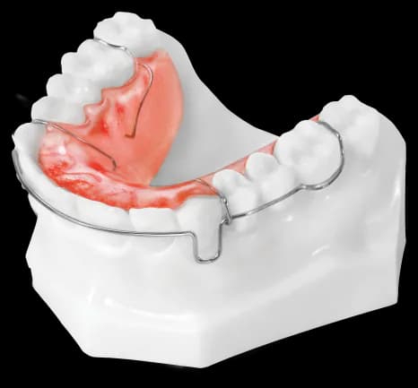 Circumferential Retainer (Upper)