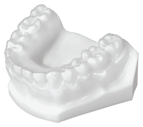 Essix (Clear Retainer) Lower
