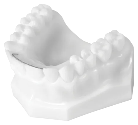 Fixed Retainer (Upper)