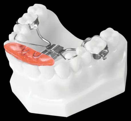 Fixed Sagittal