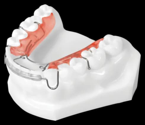 Premand Spring Retainer