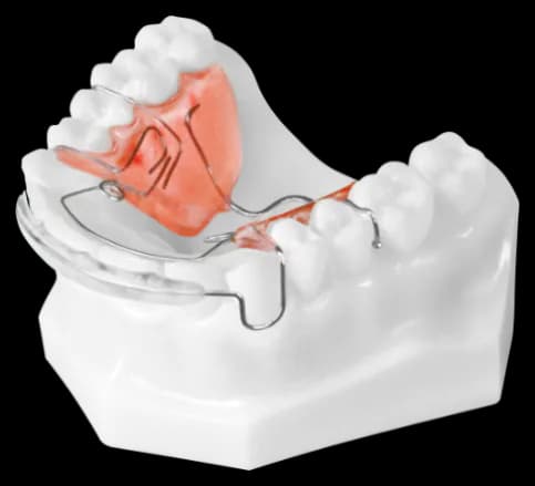 Premax Spring Retainer
