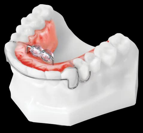 Removable Tongue Guide
