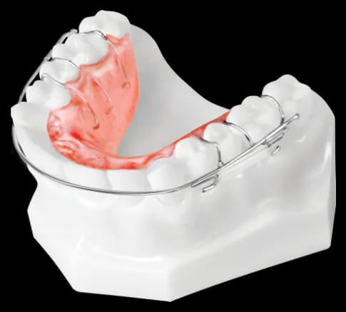 Sliding Retainer