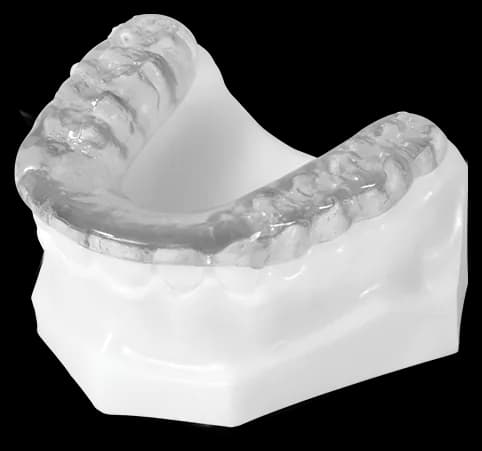 Standard Splint (Hard Acrylic Night Guard)