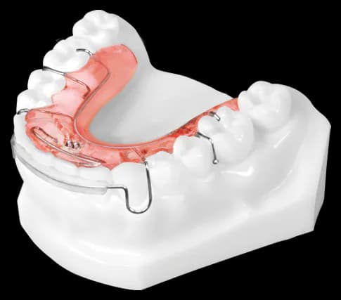 Standard Spring Retainer (Lower)