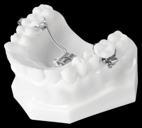 TAD MDS (Molar Distalizer with Screw)