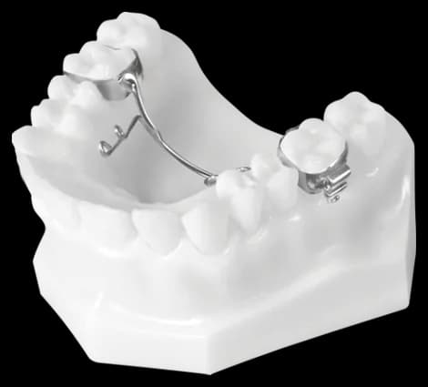 TAD TPA (Transpalatal Arch Sagittalizer)