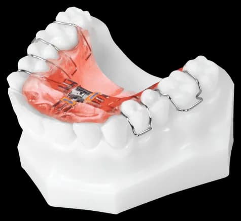Three Way Expander