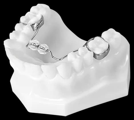 Tongue Guide Bead (Bluegrass Style)