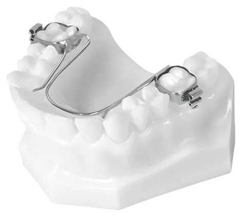 W-Arch (Upper)